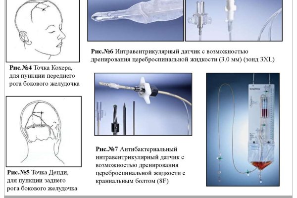 Кракен магазин наркотиков